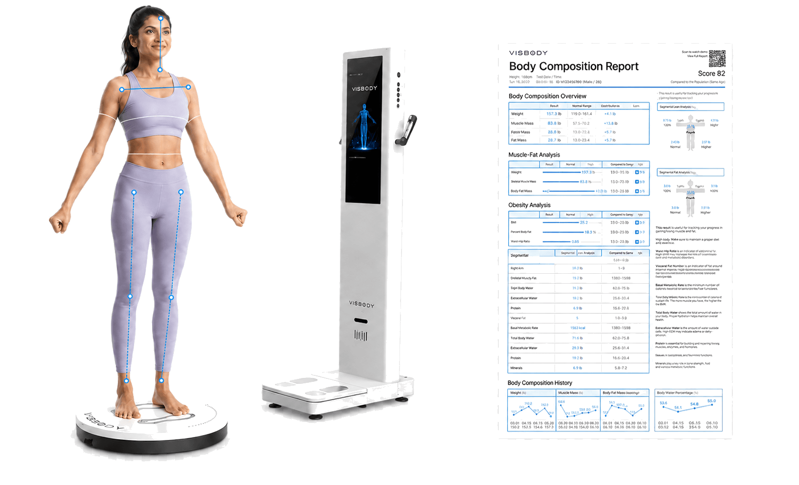 A patient being 3D-scanned on the Visbody S30, next to a sample body composition report